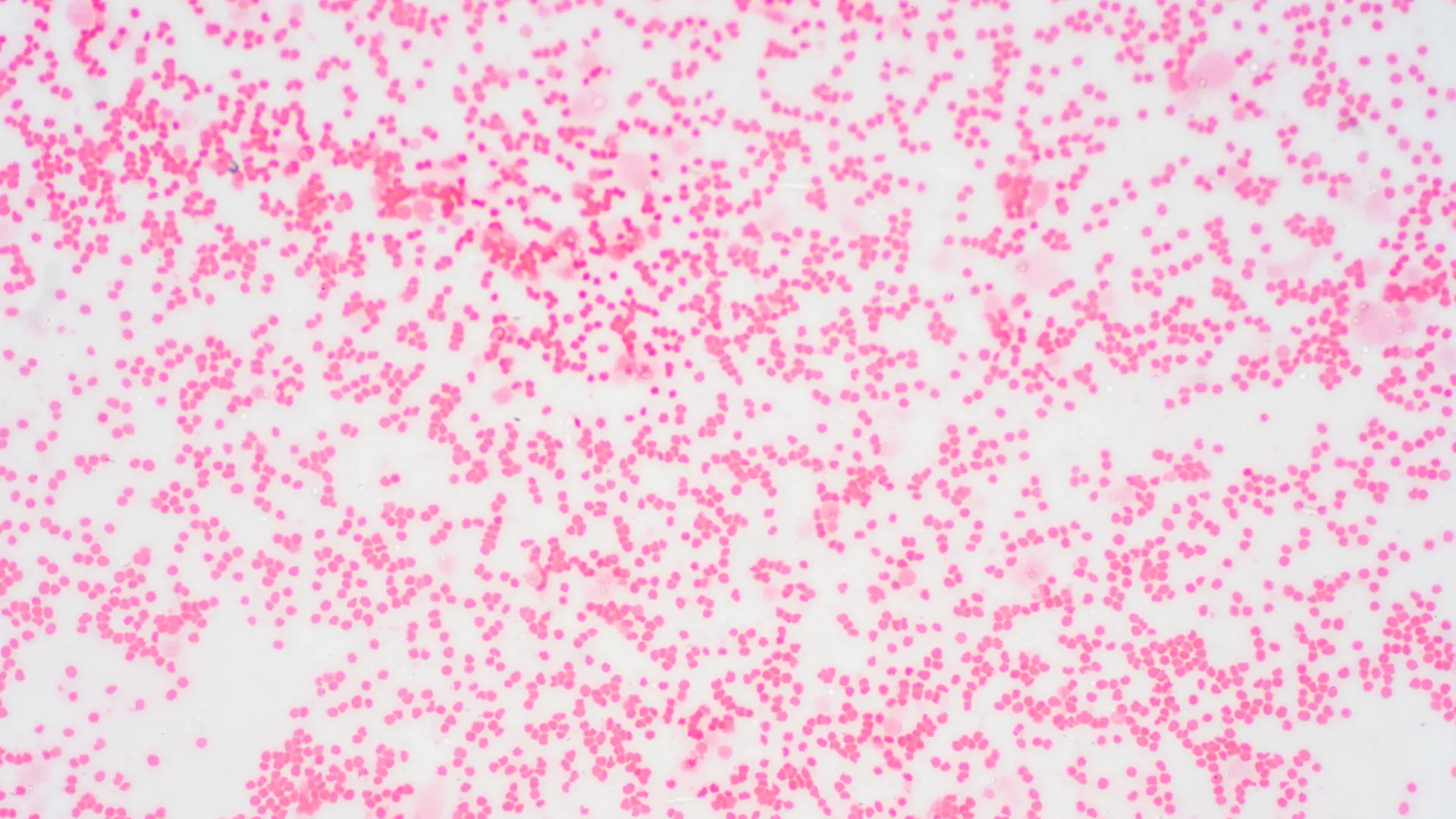 Wstępna diagnostyka chorób szpiku i chłoniaków w Krakowie