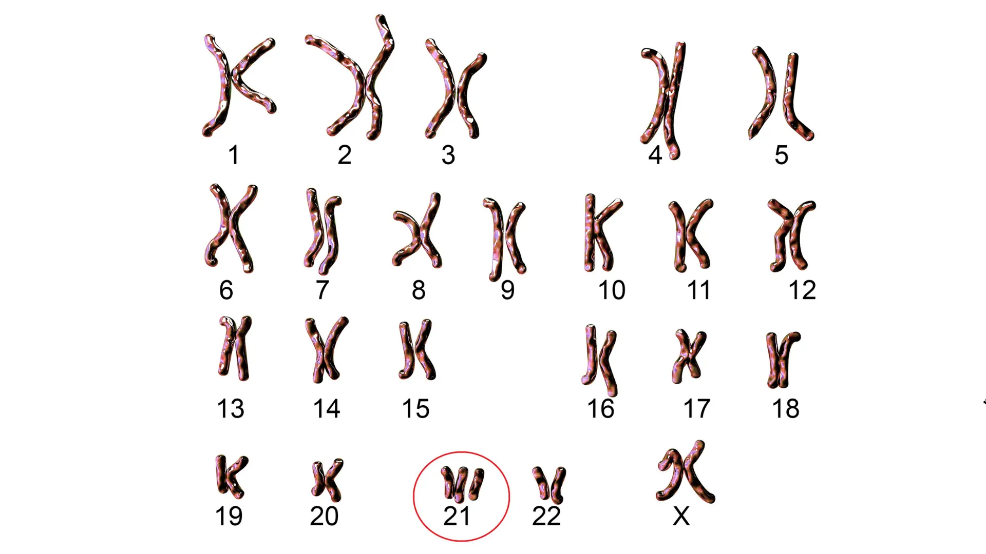 Usługa Komputerowa ocena ryzyka w kierunku trisomii 13,18, 21 w CM Femmemedica