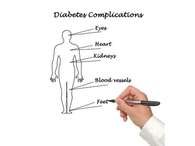 Jakie Są Długoterminowe Powikłania Nieleczonej Cukrzycy i Otyłości?