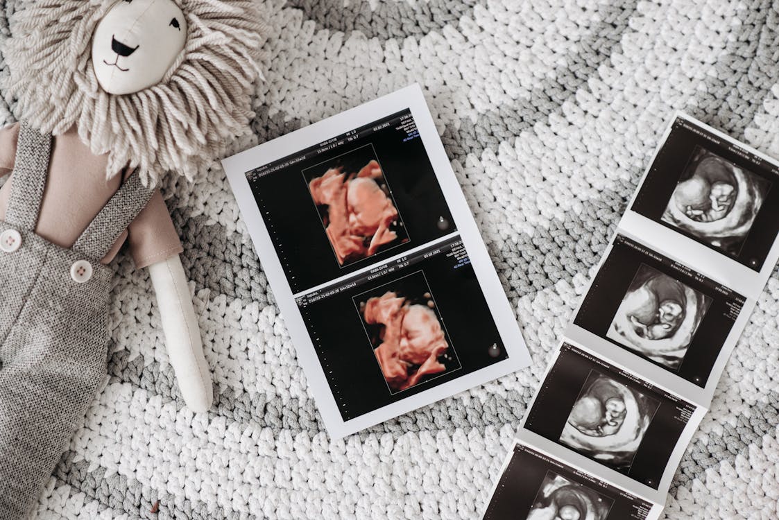 Badania USG Prenatalne 3D/4D w Krakowie – Zobacz Swoje Dziecko w CM Femmemedica