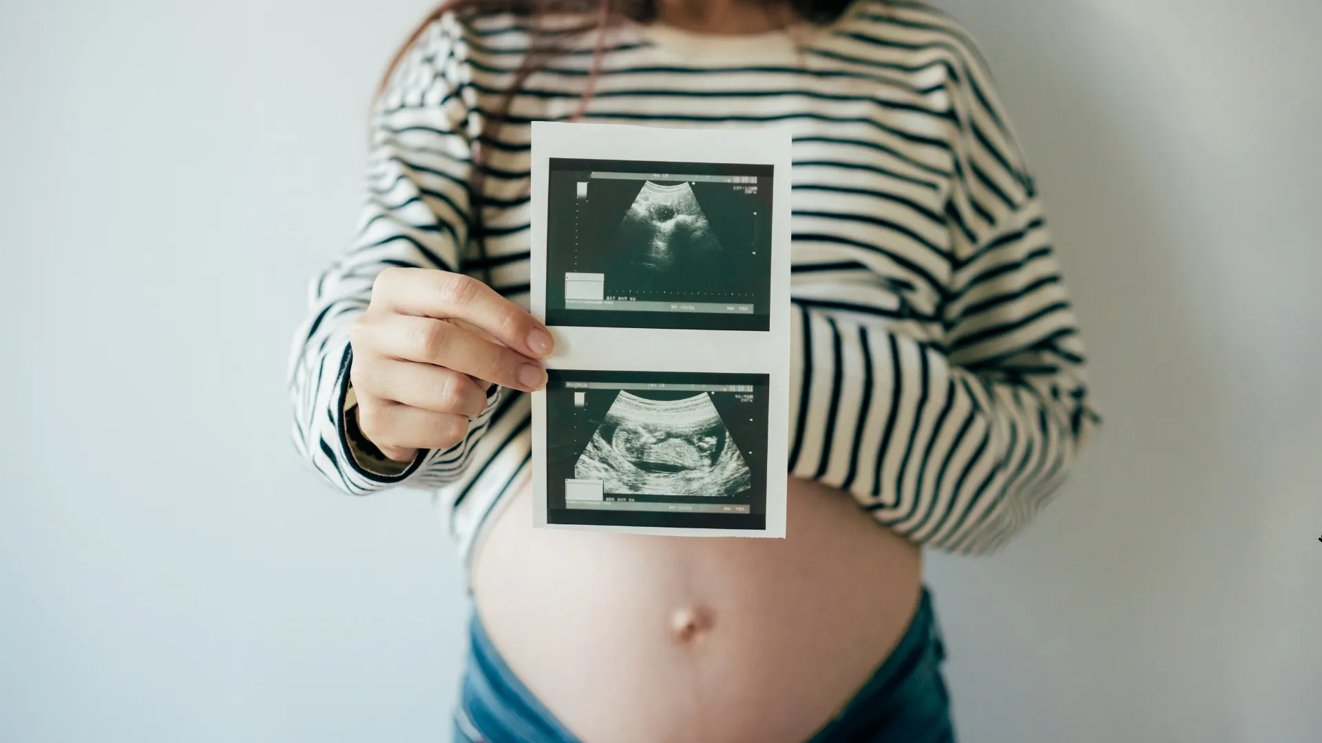 Badania USG prenatalne w CM Femmemedica Kraków